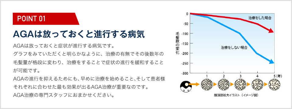 AGAは放っておくと進行する病気