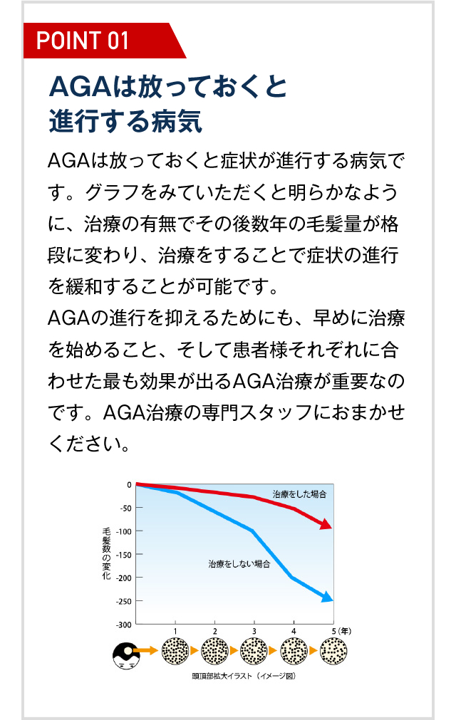 AGAは放っておくと進行する病気