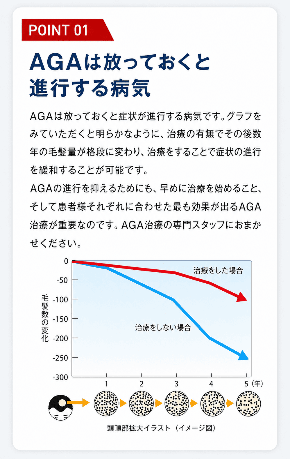 AGAは放っておくと進行する病気